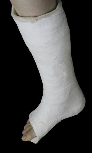 plaster on right leg